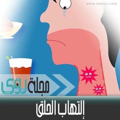 تعرف على أسباب التهاب الحلق وعلاجه