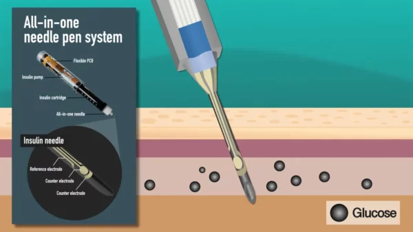 جهازان مبتكران لقياس السكر في الدم وحقن الأنسولين بسهولة