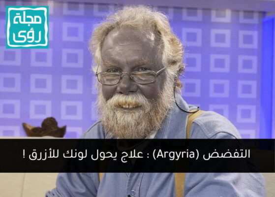 التفضض (Argyria) : العلاج بالفضة الغروية قد يحول لونك للأزرق !